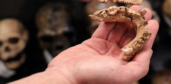 Fossil teeth show how brains developed in utero over millions of years evolution