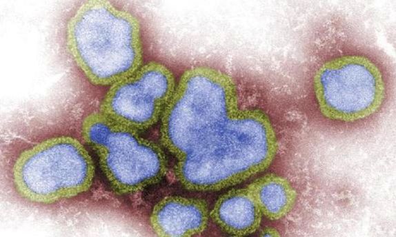 China reports human case of H3N8 bird flu