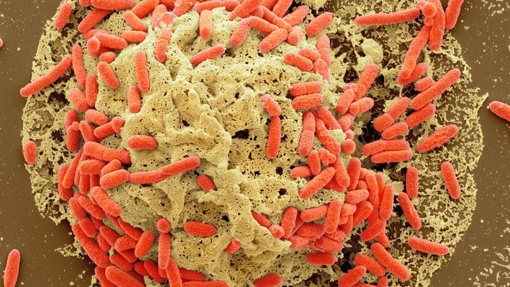 Colon cancer is rising in young people and scientists got a clue about why