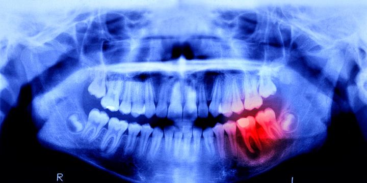Humans May Be Able to Grow New Teeth Within Just 4 Years