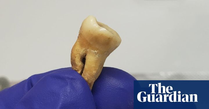 Mass grave in Jordan sheds new light on world's earliest recorded pandemic