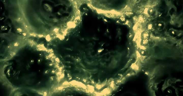 Cells use 'bioelectricity' to coordinate and make group decisions