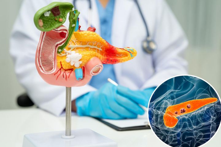 Pancreatic cancer researchers' latest breakthrough could help tumors disappear