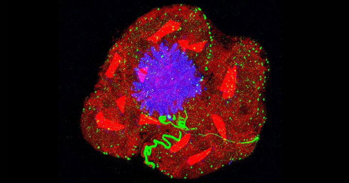 Expansion Microscopy Has Transformed How We See the Cellular World