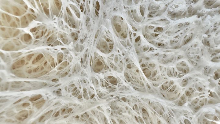 Death by Fermented Food