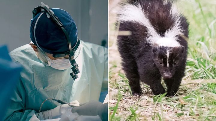 Michigan man dies of rabies after receiving kidney from infected donor