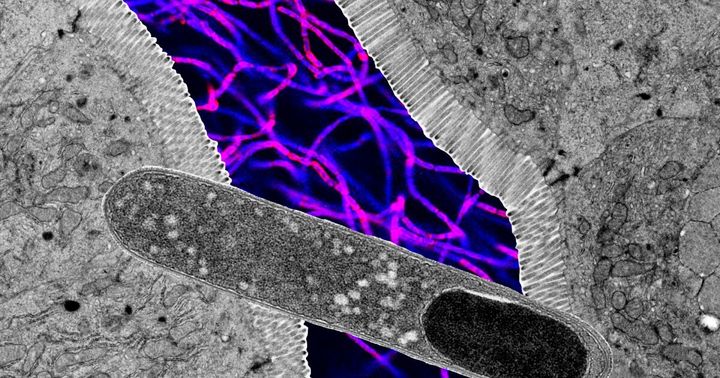 Gut microbe Turicibacter prevents weight gain