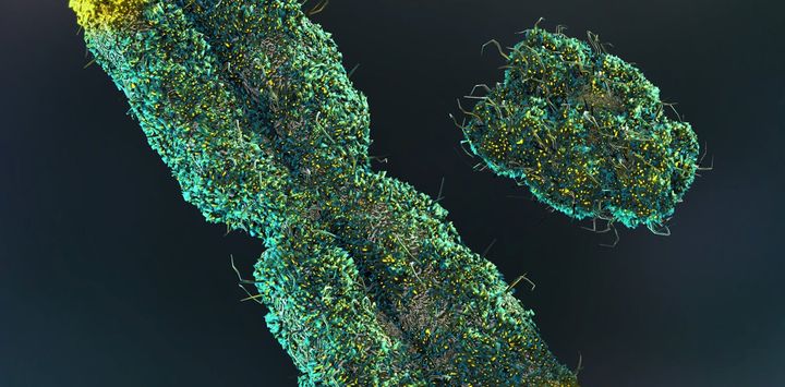 Men lose their Y chromosome as they age – how it may matter